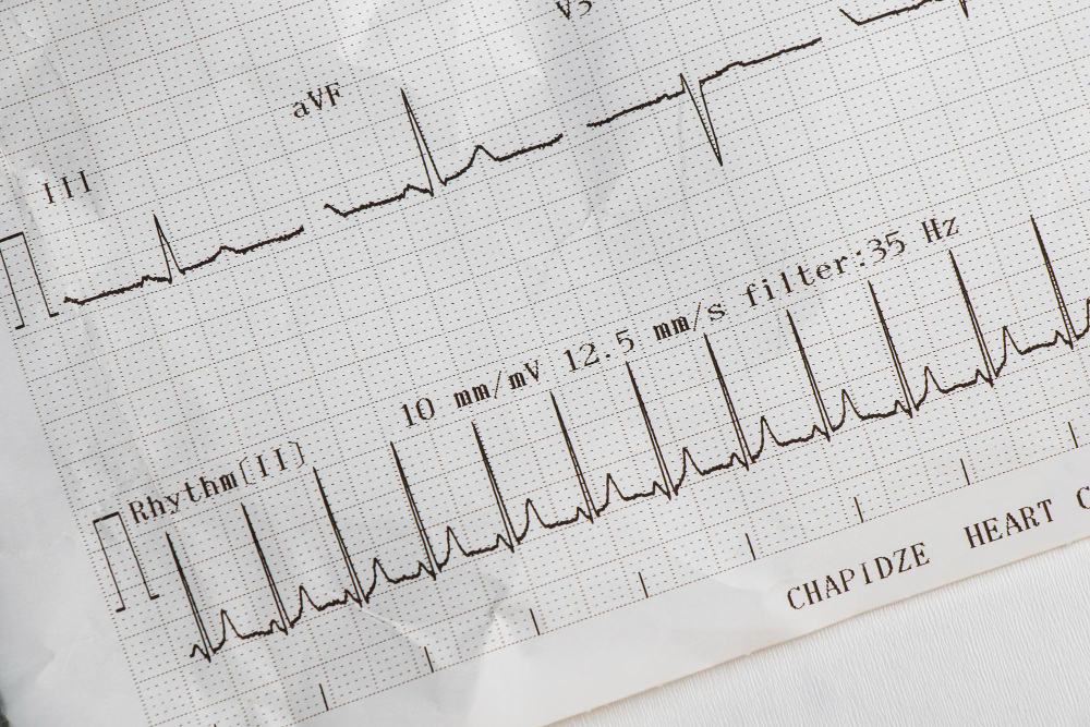 EKG in Flushing & Jamaica
