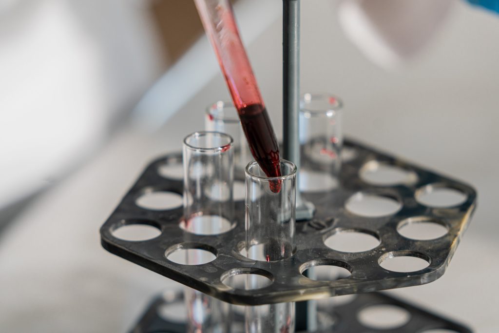 Lab Services in Flushing & Jamaica